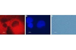 Expression of CLIC4 in human pancreatic carcinoma PANC-1 cells - Immunocytochemical staining of fixed and permeabilized human pancreatic carcinoma PANC-1 cells. (CLIC4 Antikörper  (Intracellular))