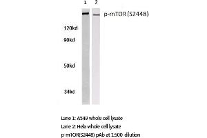 Western blot (WB) analysis of p-mTOR antibody in extracts from A549 and Hela cells. (MTOR Antikörper  (pSer2448))