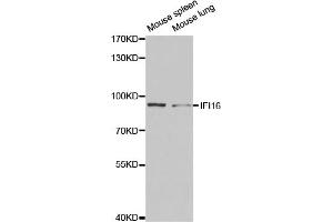 Western blot analysis of extracts of various cell lines, using IFI16 antibody (ABIN5971048) at 1/1000 dilution. (IFI16 Antikörper)
