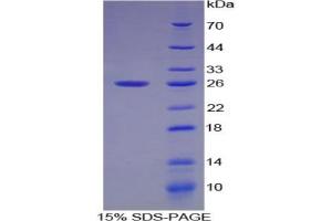 SDS-PAGE analysis of Cow Smad1 Protein. (SMAD1 Protein)