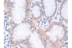 Detection of CTNNa1 in Human Stomach Tissue using Polyclonal Antibody to Catenin Alpha 1 (CTNNa1) (CTNNA1 Antikörper  (AA 2-228))