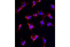 Immunofluorescence analysis of anti-NANOS1 Antibody (C-term) in HeLa cells. (Nanos Homolog 1 Antikörper  (C-Term))