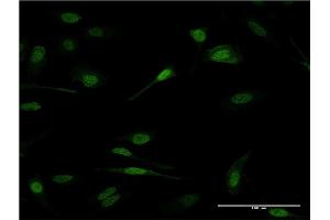 Immunofluorescence of monoclonal antibody to PRDM1 on HeLa cell. (PRDM1 Antikörper  (AA 422-493))