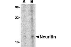 Western Blotting (WB) image for anti-Neuritin 1 (NRN1) (Middle Region) antibody (ABIN1031012)