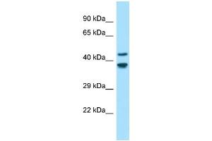 Western Blotting (WB) image for anti-Gliomedin (GLDN) (N-Term) antibody (ABIN2790542) (GLDN Antikörper  (N-Term))