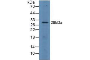 Detection of FOSL1 in Rat Spleen Tissue using Polyclonal Antibody to FOS Like Antigen 1 (FOSL1) (FOSL1 Antikörper  (AA 1-271))