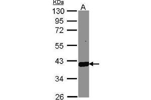 Western Blotting (WB) image for anti-Aldo-Keto Reductase Family 1, Member C3 (3-alpha Hydroxysteroid Dehydrogenase, Type II) (AKR1C3) (C-Term) antibody (ABIN2855872)