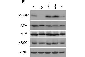 Western Blotting (WB) image for anti-Ataxia Telangiectasia Mutated (ATM) (AA 1974-1988), (pSer1981) antibody (ABIN6656104)