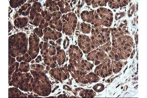 Image no. 3 for anti-Chaperonin Containing TCP1, Subunit 8 (Theta)-Like 2 (CCT8L2) antibody (ABIN1497479)