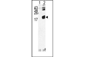 Image no. 1 for anti-beta-2-Microglobulin (B2M) (N-Term) antibody (ABIN357931)