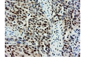 Immunohistochemical staining of paraffin-embedded Human Kidney tissue using anti-NT5DC1 mouse monoclonal antibody. (NT5DC1 Antikörper)