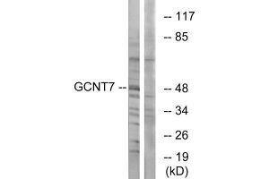 Western Blotting (WB) image for anti-Glucosaminyl (N-Acetyl) Transferase Family Member 7 (GCNT7) (C-Term) antibody (ABIN1850894) (GCNT7 Antikörper  (C-Term))
