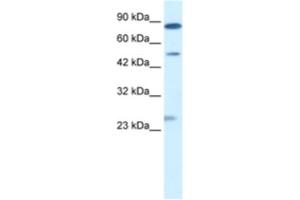 Western Blotting (WB) image for anti-Chloride Channel, Voltage-Sensitive 6 (CLCN6) antibody (ABIN2461139)