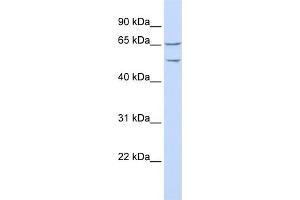 WB Suggested Anti-TTYH1 Antibody Titration:  0. (TTYH1 Antikörper  (N-Term))