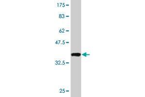 Western Blot detection against Immunogen (36. (EHMT1 Antikörper  (AA 1-100))