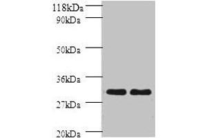 Western blot All lanes: HLA-DPB1 antibody at 2 μg/mL Lane 1: sw1990 whole cell lysate Lane 2: HGC27 whole cell lysate Secondary Goat polyclonal to rabbit IgG at 1/10000 dilution Predicted band size: 30 kDa Observed band size: 30 kDa (HLA-DPB1 Antikörper  (AA 30-225))