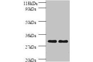 Western blot All lanes: HLA-DPB1 antibody at 2 μg/mL Lane 1: sw1990 whole cell lysate Lane 2: HGC27 whole cell lysate Secondary Goat polyclonal to rabbit IgG at 1/10000 dilution Predicted band size: 30 kDa Observed band size: 30 kDa