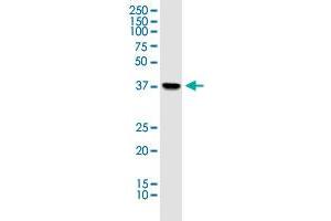 Western Blotting (WB) image for anti-Pyruvate Dehydrogenase (Lipoamide) alpha 1 (PDHA1) (AA 1-390) antibody (ABIN518747)