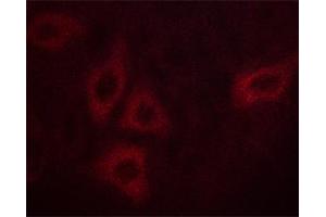 ABIN6267562 staining HepG2 cells by ICC/IF. (Calmodulin 1 Antikörper  (pSer81, pThr79))