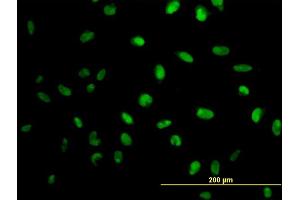 Immunofluorescence of monoclonal antibody to MPG on HeLa cell. (MPG Antikörper  (AA 1-90))