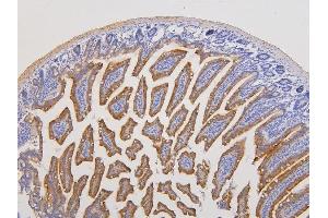 IHC analysis of RAB3GAP2 using anti-RAB3GAP2 antibody (ABIN6719633). (RAB3GAP2 Antikörper  (AA 1-115))