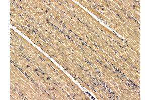 ABIN7095950 and ABIN7100012 at 1/100 staining rat muscle tissue by IHC-P. (SCYL3 Antikörper)