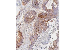 IHC analysis of CDK1 using anti-CDK1 antibody (ABIN7602240). (CDK1 Antikörper  (AA 66-297))