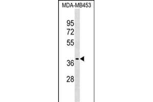 P2RX3 Antibody (C-term) (ABIN1537144 and ABIN2850268) western blot analysis in MDA-M cell line lysates (35 μg/lane).