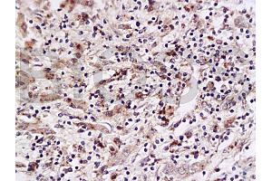 Immunohistochemistry (IHC) image for anti-Placenta Growth Factor (PGF) (AA 166-221) antibody (ABIN727235) (PLGF Antikörper  (AA 166-221))