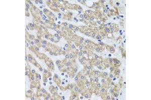 Immunohistochemistry of paraffin-embedded human liver injury using ACP1 antibody at dilution of 1:100 (x40 lens). (ACP1 Antikörper)