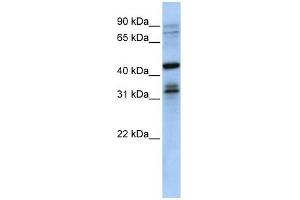 MSI2 antibody used at 1 ug/ml to detect target protein. (MSI2 Antikörper)