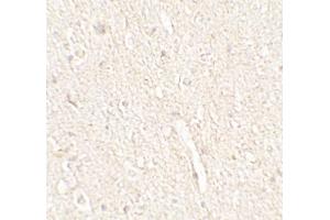 Immunohistochemistry (IHC) image for anti-Energy Homeostasis Associated (ENHO) (C-Term) antibody (ABIN2457882) (ENHO Antikörper  (C-Term))