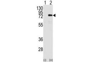 Western Blotting (WB) image for anti-Protein Kinase C, eta (PRKCH) antibody (ABIN3002933) (PKC eta Antikörper)