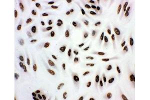 ICC testing of A549 cells (HDAC3 Antikörper  (AA 411-428))