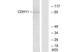 Western Blotting (WB) image for anti-Cadherin 11 (CDH11) (Internal Region) antibody (ABIN1850214) (OB Cadherin Antikörper  (Internal Region))
