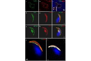 Localization of mTAS1R3 (green) and CD46 (red) in mouse sperm revealed by Confocal Microscopy and Structure Illumination Microscopy (SIM). (CD46 Antikörper)