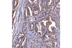 IHC analysis of TOMM34 using anti-TOMM34 antibody (ABIN7599253). (TOMM34 Antikörper  (AA 1-309))