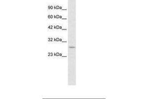 Image no. 2 for anti-Ring Finger Protein 141 (RNF141) (AA 96-145) antibody (ABIN6735889) (RNF141 Antikörper  (AA 96-145))
