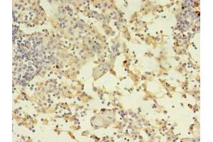 Immunohistochemistry of paraffin-embedded human thymus tissue using ABIN7150034 at dilution of 1:100 (A Disintegrin and Metallopeptidase Domain 1a (ADAM1A) (AA 214-504) Antikörper)