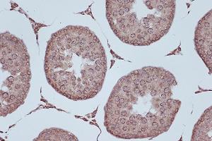 Immunohistochemistry of paraffin-embedded rat testis using RanG Rabbit mAb (ABIN7269846) at dilution of 1:100 (40x lens). (RANGAP1 Antikörper)