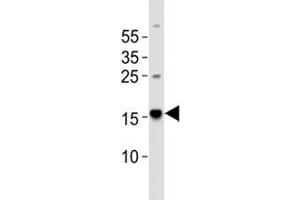 Western blot analysis of lysate from human brain tissue using Map1lc3a antibody diluted at 1:1000.