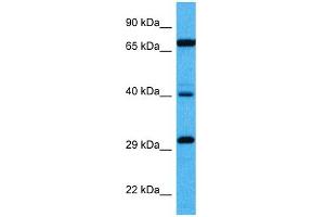 Host:  Mouse  Target Name:  DMTF1  Sample Tissue:  Mouse Kidney  Antibody Dilution:  1ug/ml (DMP1 Antikörper  (Middle Region))