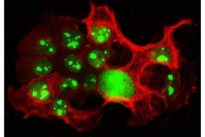 IF analysis of NCL using anti-NCL antibody (ABIN7600662) and anti-Tubulin beta antibody (ABIN7602744).
