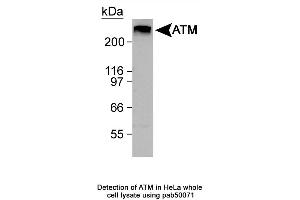 Image no. 1 for anti-Ataxia Telangiectasia Mutated (ATM) (C-Term) antibody (ABIN363380) (ATM Antikörper  (C-Term))