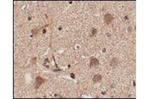 Immunohistochemistry of Slitrk5 in human brain tissue with this product at 2. (SLITRK5 Antikörper  (Center))