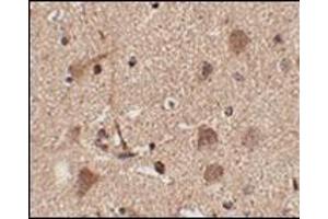 Immunohistochemistry of Slitrk5 in human brain tissue with this product at 2.