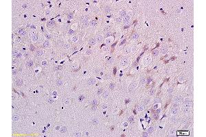 Formalin-fixed and paraffin embedded rat brain labeled with Anti-ErbB-3/HER3 Polyclonal Antibody, Unconjugated (ABIN686767) at 1:200 followed by conjugation to the secondary antibody and DAB staining. (ERBB3 Antikörper  (AA 661-760))