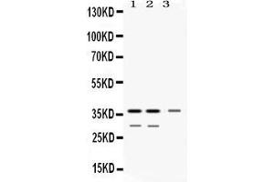 Western blot analysis of DDAH1 expression in rat kidney extract ( Lane 1), mouse kidney extract ( Lane 2) and HELA whole cell lysates ( Lane 3).