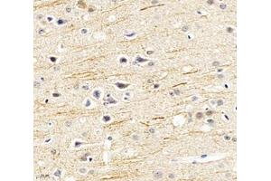 Immunohistochemistry analysis of paraffin-embedded mouse hippocampus using SCN8A (ABIN7075647) at dilution of 1: 1200 (SCN8A Antikörper)