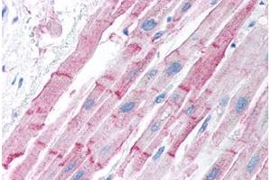Human Heart (formalin-fixed, paraffin-embedded) stained with ESR2 antibody ABIN214750 at 5 ug/ml followed by biotinylated goat anti-rabbit IgG secondary antibody ABIN481713, alkaline phosphatase-streptavidin and chromogen. (ESR2 Antikörper  (AA 82-131))